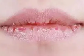 小小一瓶维生素B2，便宜但有大作用！能防治这些病图片