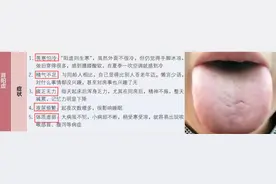 肾不好的六种情况，你是哪一种？图片