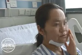 嘴巴里长出巨大肿瘤！女子还以为：“上火了”图片