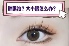 肿眼泡，大小眼怎么办？图片