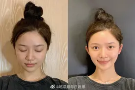 “高考后去隆胸，我被男友甩了”图片