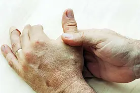 老年人易被帕金森盯上，做好这4点，帕金森病不会轻易找上门来图片