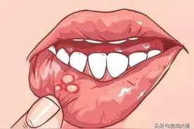 吃东西频繁咬到舌头，就是要中风了图片