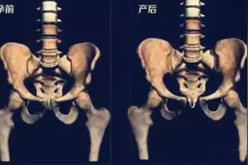 孕妈的肚子怎么可以那么大？看看内脏被挤成啥样，女人当妈不容易图片