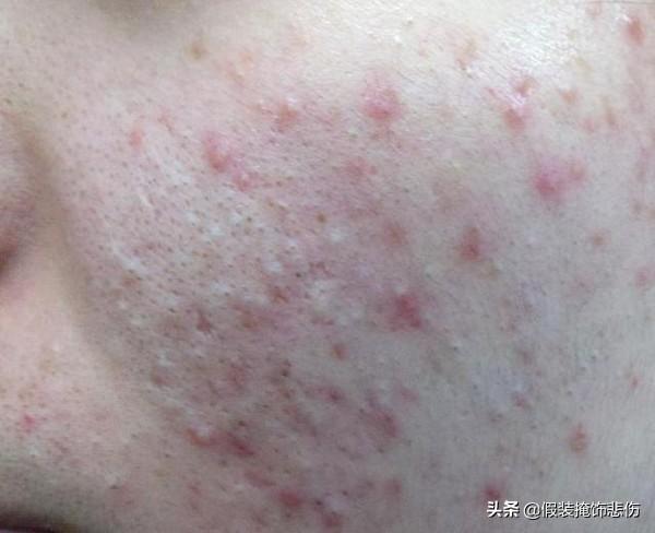 除螨硫磺皂红黑榜pk！最好用的永远是它，躺赢国货之光上海硫磺皂