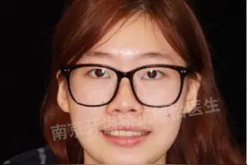 南京牙齿矫正邰怡｜Tiger正畸故事：愿微笑成为你的自信之光图片