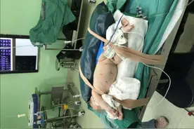 贵州2个月大患儿成功接受达芬奇机器人手术图片