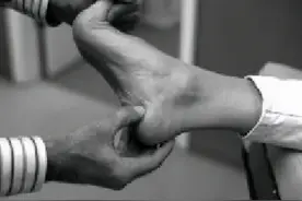 走路足跟疼痛，小心跟骨骨刺！跟骨骨刺需要拔刺吗？图片