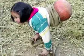 还记得20年前的“篮球女孩”吗？现在装上假肢后，众人都为她高兴图片