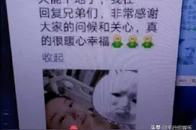 YY菲儿手术，挺毕加索年度对战图片