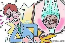 结石到底是什么东西？人体为什么会长石头？今天才知道真相。图片
