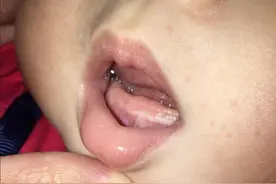 宝宝出牙早晚与什么有关？原因挺复杂，但有必要为孩子留意图片