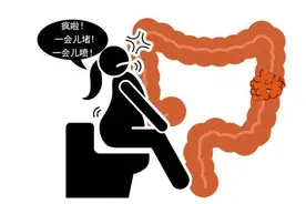 提醒便秘患者：排便若伴有4种异常，需尽快查下肠镜，别拖成肠癌图片