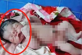 50岁孕妇产子，脸似“猪八戒”吓坏老公，医生一番话救了孩子图片