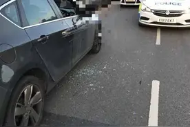 人如果47天不排便会怎么样？体内的“屎”去哪了？答案很简单图片