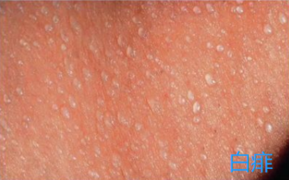 小孩胳膊膝盖鸡皮肤图片大全