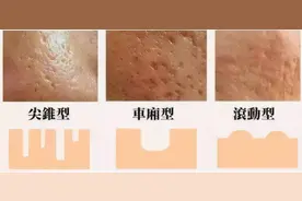 网传最值得做的3大医美项目，你尝试过几个？爱美的姐妹们快看看图片