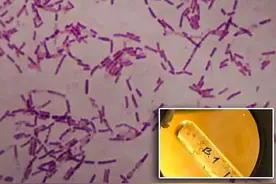 疯狂科学家为了永生,给自己注射350万年前的细菌,他现在怎么样了?图片