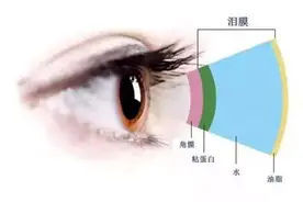 最近高发！手机不离手的人，警惕这种偷视力的病图片