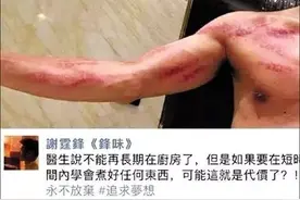 骨科大夫详解有一种不爽，叫筋膜炎图片
