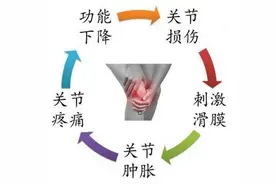 膝盖滑膜炎一直不好？教你3个动作缓解膝盖疼痛图片