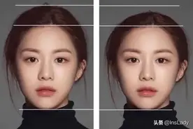 又一个被“自残式整容”手术毁掉的中国女孩，好可怕...图片