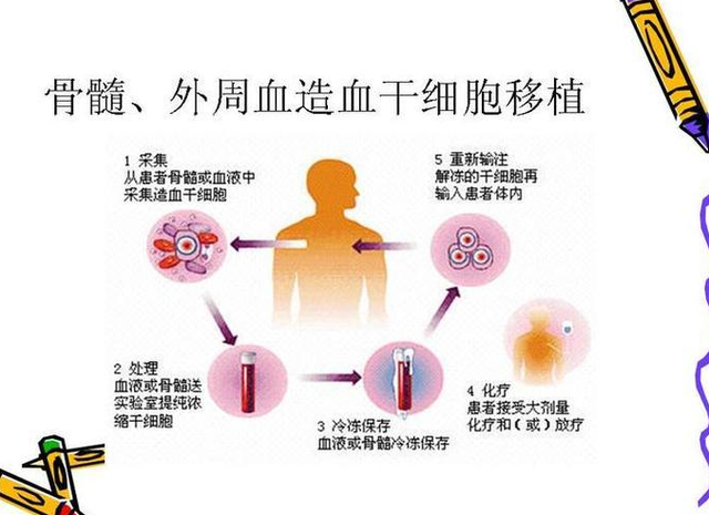 白血病患者能完全治好吗？医生说：有可能，看身体状况，分年龄