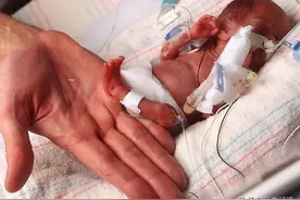 女婴出生时仅25厘米，打破了世界纪录，她后来咋样了图片