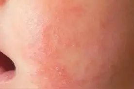 夏天坐月子，作为过来人，给产妇的建议图片