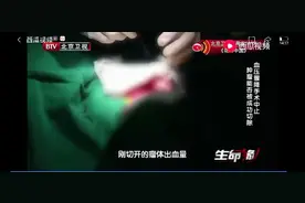 9岁女童腹痛难忍，确诊癌症之王！医生告诫家长：不要忽视3件事图片