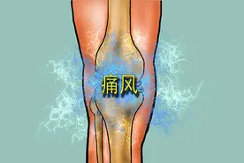 列出尿酸高的三种典型症状，对照看看，若有，及时改善图片