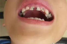 奶奶经常给孩子喝这种牛奶，娃的身高落后别人一大截，还长了蛀牙图片