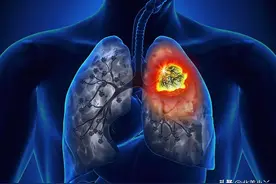 长期住土壤裸露的平房或家里有此类地下室，会增加肺癌的几率！图片