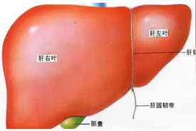 肝脏易“受伤”呵护需谨慎，专家提醒：肝硬化患者饮食要“讲究”图片