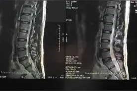 不一样的腿麻 不一样的思路图片