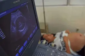 26岁孕妇生下龙凤胎，正要缝合时她却大叫“等下”，医生满脸无奈图片