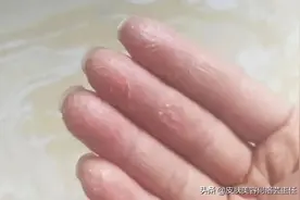 秋冬手不想干燥脱皮，使用护手霜注意这三点！不然多贵都白搭图片