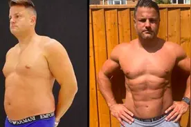 英国39岁男子花近14万元做吸脂手术，一夜之间拥有六块腹肌图片