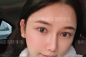 假的！这些美白祛痘方法没有用的，千万别信图片