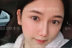 假的！这些美白祛痘方法没有用的，千万别信图片