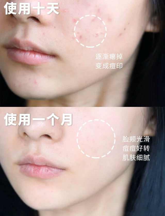 女人一直吃胶原蛋白 2026年女人一直吃胶原蛋白有用吗