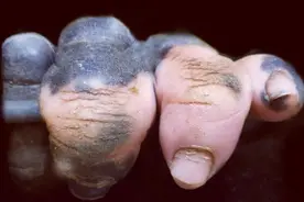 一只黑猩猩发生了基因突变，居然进化出了与人类非常相似的手指图片