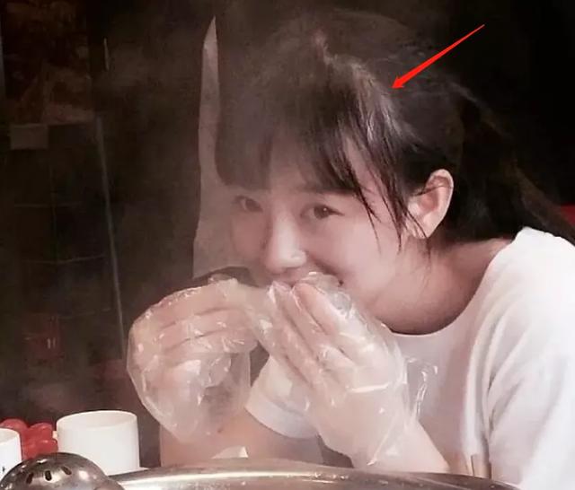 耳朵前鬓角下鸡皮疙瘩红印 耳朵前鬓角下鸡皮疙瘩红印