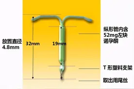 这个小玩意不仅能防“意外”，还能治疗妇科病图片
