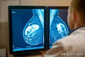 乳腺癌一查就是晚期？其实身体早早就给了暗示，只是大多数不在意图片