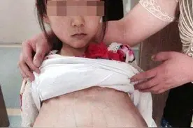 9岁女儿总喊“胃疼”，宝妈以为是胃炎，送医检查后医生：来晚了图片