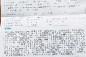 孕23周，胎儿畸形做引产的经历图片
