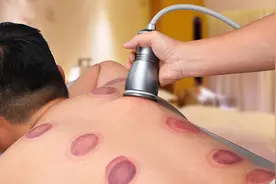 养生大行其道，科学刮痧更能全身排毒图片