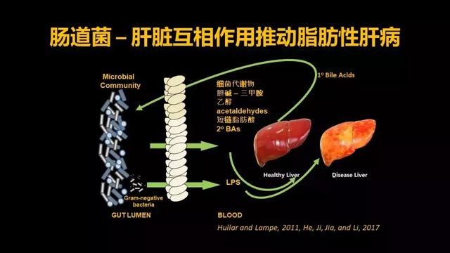 贾伟：肝病肠治？且看肠道细菌如何对肝病推波助澜