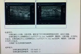 体检发现乳腺结节怎么办？图片